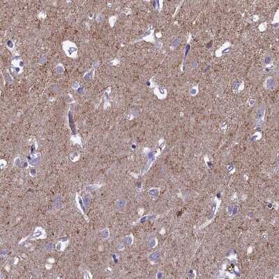 Immunohistochemistry-Paraffin: SV2C Antibody [NBP1-86239]