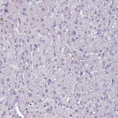 Immunohistochemistry-Paraffin: SV2C Antibody [NBP1-86239]