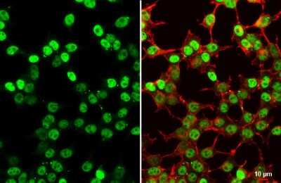 Immunocytochemistry/ Immunofluorescence: SV40 T-antigen Antibody [NBP3-13382]
