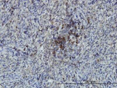 Immunohistochemistry-Paraffin: SWAP70 Antibody (3H8) [H00023075-M09]