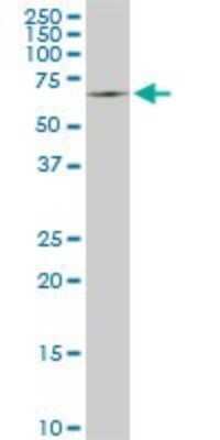Western Blot: SWAP70 Antibody (3H8) [H00023075-M09]