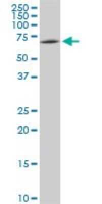 Western Blot: SWAP70 Antibody (3H8) [H00023075-M09]
