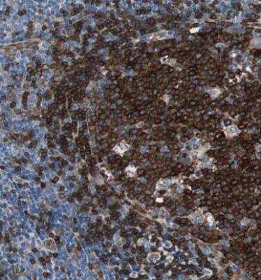 Immunohistochemistry-Paraffin: SWAP70 Antibody [NBP1-82979]