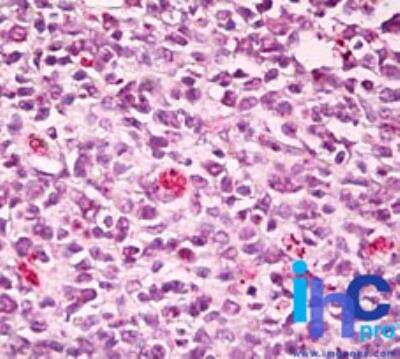 Immunohistochemistry-Paraffin: SWAP70 Antibody [NBP2-24654]