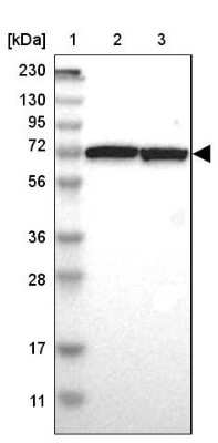 Western Blot: SWAP70 Antibody [NBP1-82979]