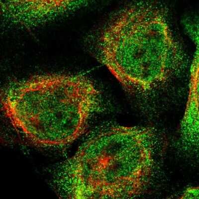 Immunocytochemistry/ Immunofluorescence: SWT1 Antibody [NBP1-90710]