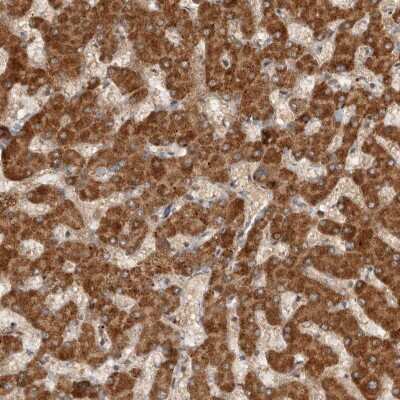 Immunohistochemistry-Paraffin: SWT1 Antibody [NBP1-90709]
