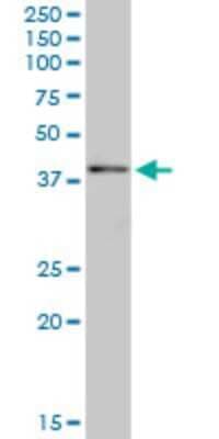 Western Blot: SYCE1 Antibody (6G7) [H00093426-M03]