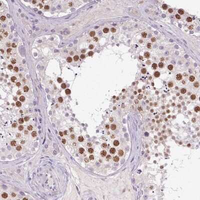Immunohistochemistry-Paraffin: SYCE2 Antibody [NBP1-90637]