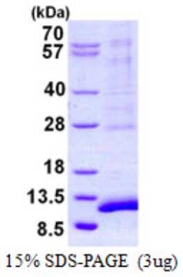 SDS-PAGE: Recombinant Human SYCE3 His Protein [NBP2-22836]