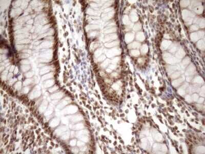 Immunohistochemistry: SYF2 Antibody (OTI6A5) [NBP2-46033]