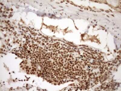 Immunohistochemistry: SYF2 Antibody (OTI6A5) [NBP2-46033]