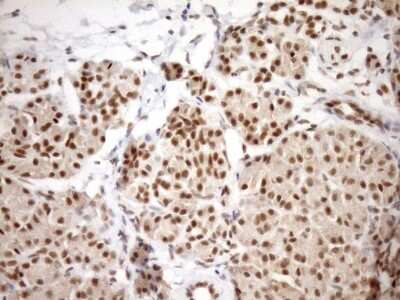 Immunohistochemistry: SYF2 Antibody (OTI6A5) [NBP2-46033]