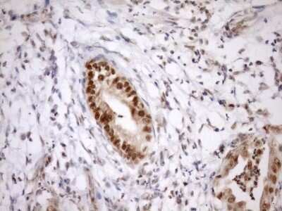 Immunohistochemistry: SYF2 Antibody (OTI6A5) - Azide and BSA Free [NBP2-74413]