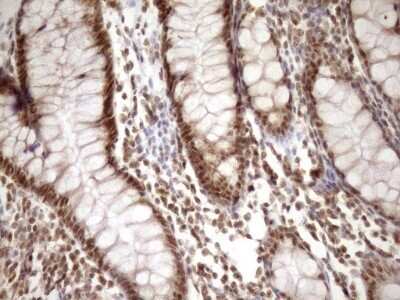 Immunohistochemistry: SYF2 Antibody (OTI6A5) - Azide and BSA Free [NBP2-74413]