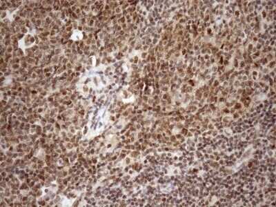 Immunohistochemistry: SYF2 Antibody (OTI6A5) - Azide and BSA Free [NBP2-74413]