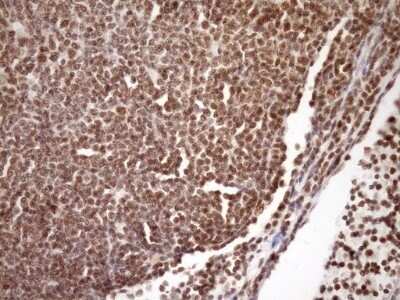 Immunohistochemistry: SYF2 Antibody (OTI6A5) - Azide and BSA Free [NBP2-74413]