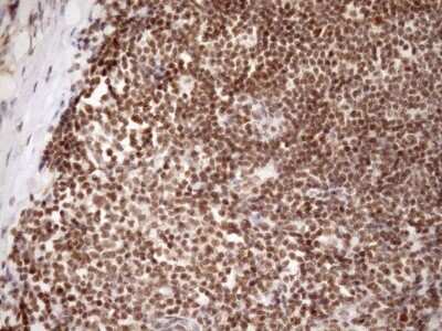 Immunohistochemistry: SYF2 Antibody (OTI6A5) - Azide and BSA Free [NBP2-74413]