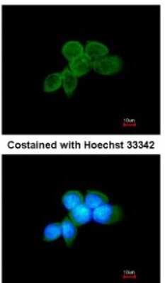 Immunocytochemistry/ Immunofluorescence: SYK Antibody [NBP1-32945]