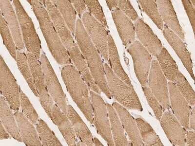 Immunohistochemistry-Paraffin: SYNE1 Antibody [NBP2-98081]