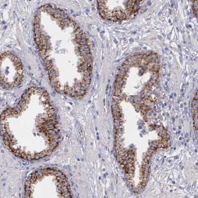 Immunohistochemistry-Paraffin: SYNJ2BP/ARIP2 Antibody [NBP1-88985]