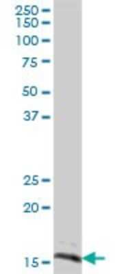 Western Blot: SYNJ2BP/ARIP2 Antibody [H00055333-B01P]