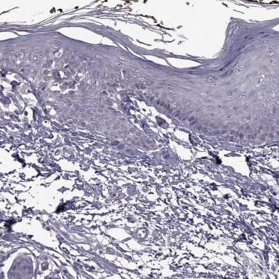 Immunohistochemistry-Paraffin: SYNPO2 Antibody [NBP2-57202]