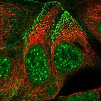 Immunocytochemistry/ Immunofluorescence: SYNPO2L Antibody [NBP2-33741]