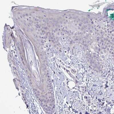 Immunohistochemistry-Paraffin: SYNPO2L Antibody [NBP2-33741]