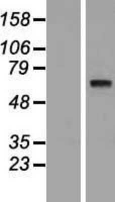 Western Blot: SYT10 Overexpression Lysate [NBP2-04657]