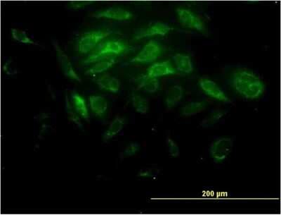 Immunocytochemistry/ Immunofluorescence: SYT11 Antibody (4E1) [H00023208-M03]