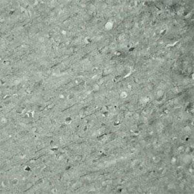 Immunohistochemistry: SYT17 Antibody - Azide and BSA Free [NBP1-03494]