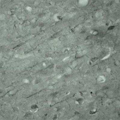 Immunohistochemistry: SYT17 Antibody - Azide and BSA Free [NBP1-03494]