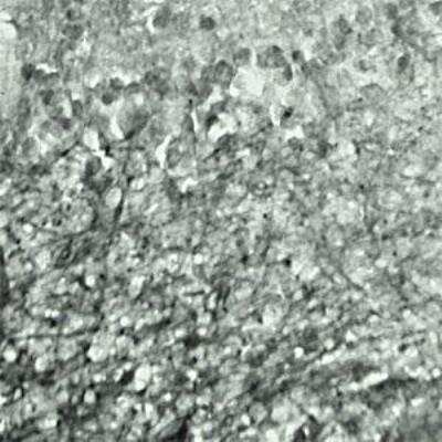 Immunohistochemistry: SYT17 Antibody - Azide and BSA Free [NBP1-03494]