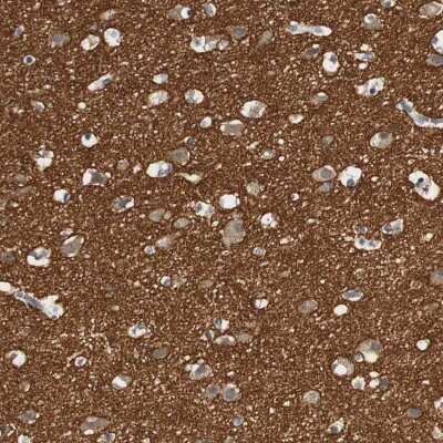 Immunohistochemistry-Paraffin: SYT7 Antibody [NBP1-81588]
