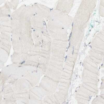 Immunohistochemistry-Paraffin: SYT7 Antibody [NBP1-81588]