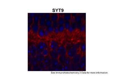 Immunohistochemistry-Paraffin: SYT9 Antibody [NBP1-60112]