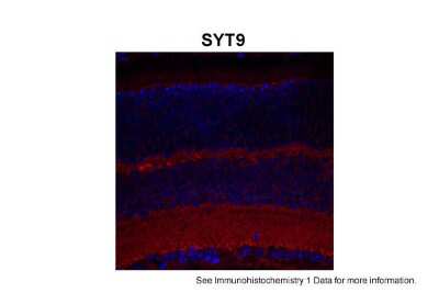 Immunohistochemistry-Paraffin: SYT9 Antibody [NBP1-60112]