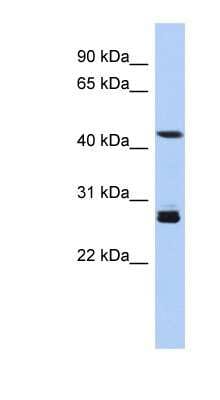 Western Blot: SYT9 Antibody [NBP1-60112]