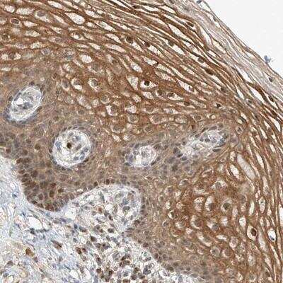Immunohistochemistry-Paraffin: SYTL3 Antibody [NBP1-83941]