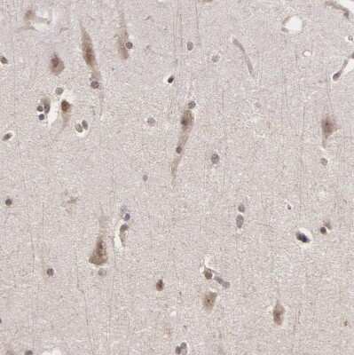 Immunohistochemistry-Paraffin: SYTL4 Antibody [NBP1-86174]