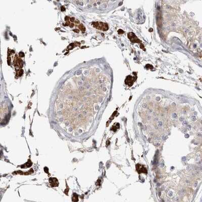 Immunohistochemistry-Paraffin: SYTL5 Antibody [NBP1-90926]