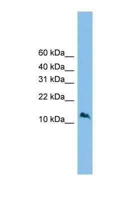 Western Blot: SZRD1 Antibody [NBP1-57737]