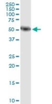 Western Blot: Salivary Amylase Alpha Antibody (2D4) [H00000276-M04]