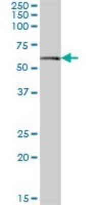 Western Blot: Salivary Amylase Beta Antibody [H00000277-B01P]