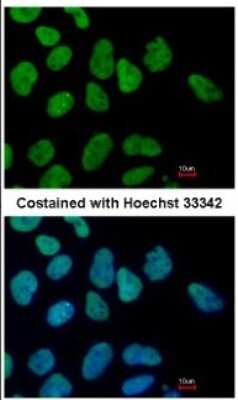 Immunocytochemistry/ Immunofluorescence: SALL4 Antibody [NBP1-32969]