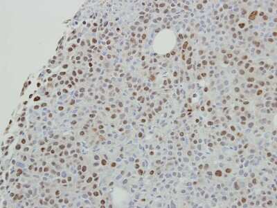 Immunohistochemistry-Paraffin: Scaffold attachment factor B2 Antibody [NBP2-20265]