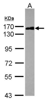 Western Blot: Scaffold attachment factor B2 Antibody [NBP2-20265]