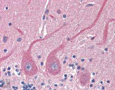 Immunohistochemistry-Paraffin: Sec8 Antibody (14G1) [NBP1-97492]