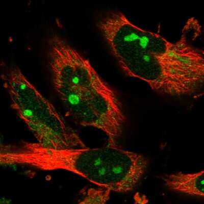 Immunocytochemistry/ Immunofluorescence: Sec8 Antibody [NBP1-89597]